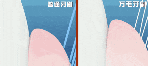 包含这10000根比头发还细软的刷毛,让每天刷牙变成享受-家核优居的词条 包含这10000根比头发还细软的刷毛,让每天刷牙变成享受-家核优居的词条