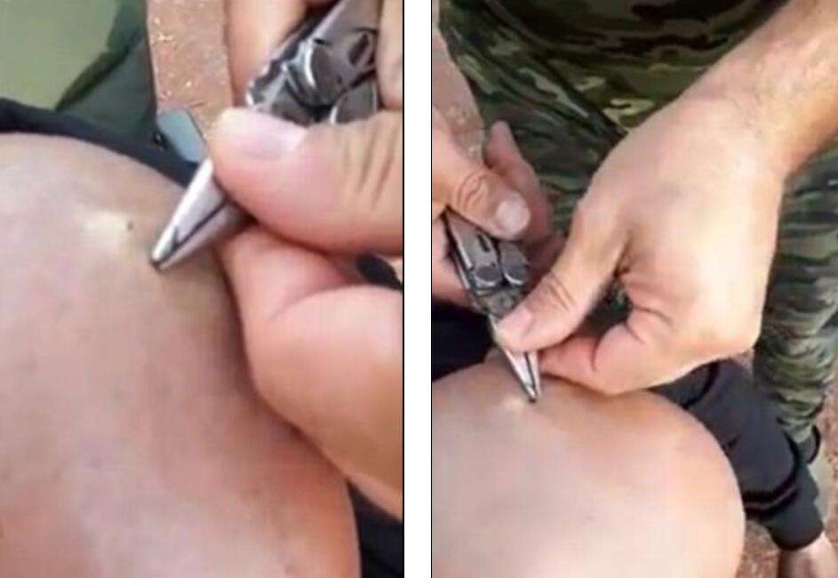 关于安徽六安一爸爸钓鱼甩鱼钩，钩住自己亲闺女。爸爸自责：我再也不钓鱼了-度小视的信息